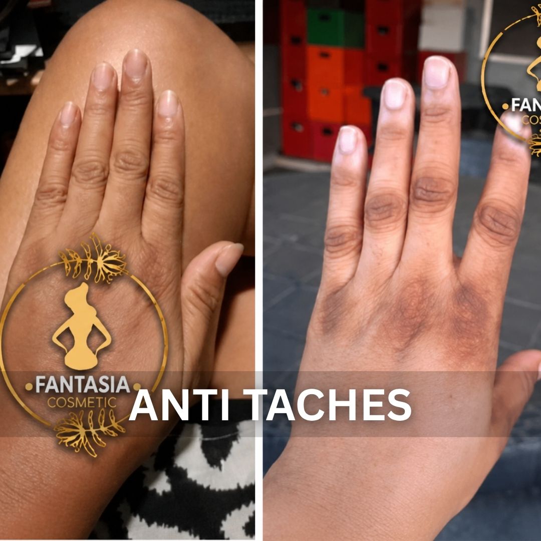 Anti Taches