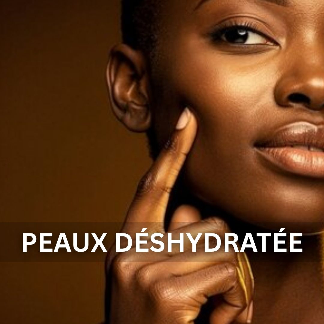 Peaux déshydratée